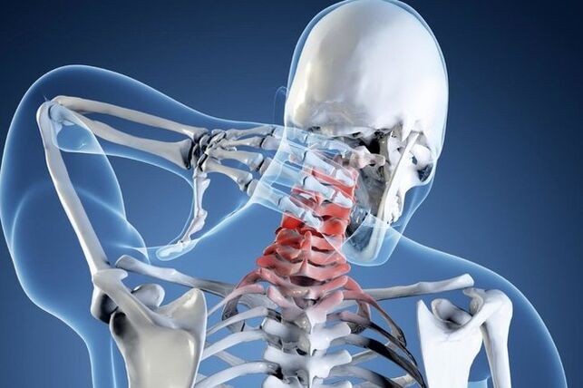 Osteochondral disease in the cervical area