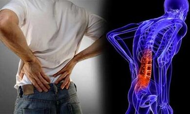 Causes of the development of lumbar vertebrae