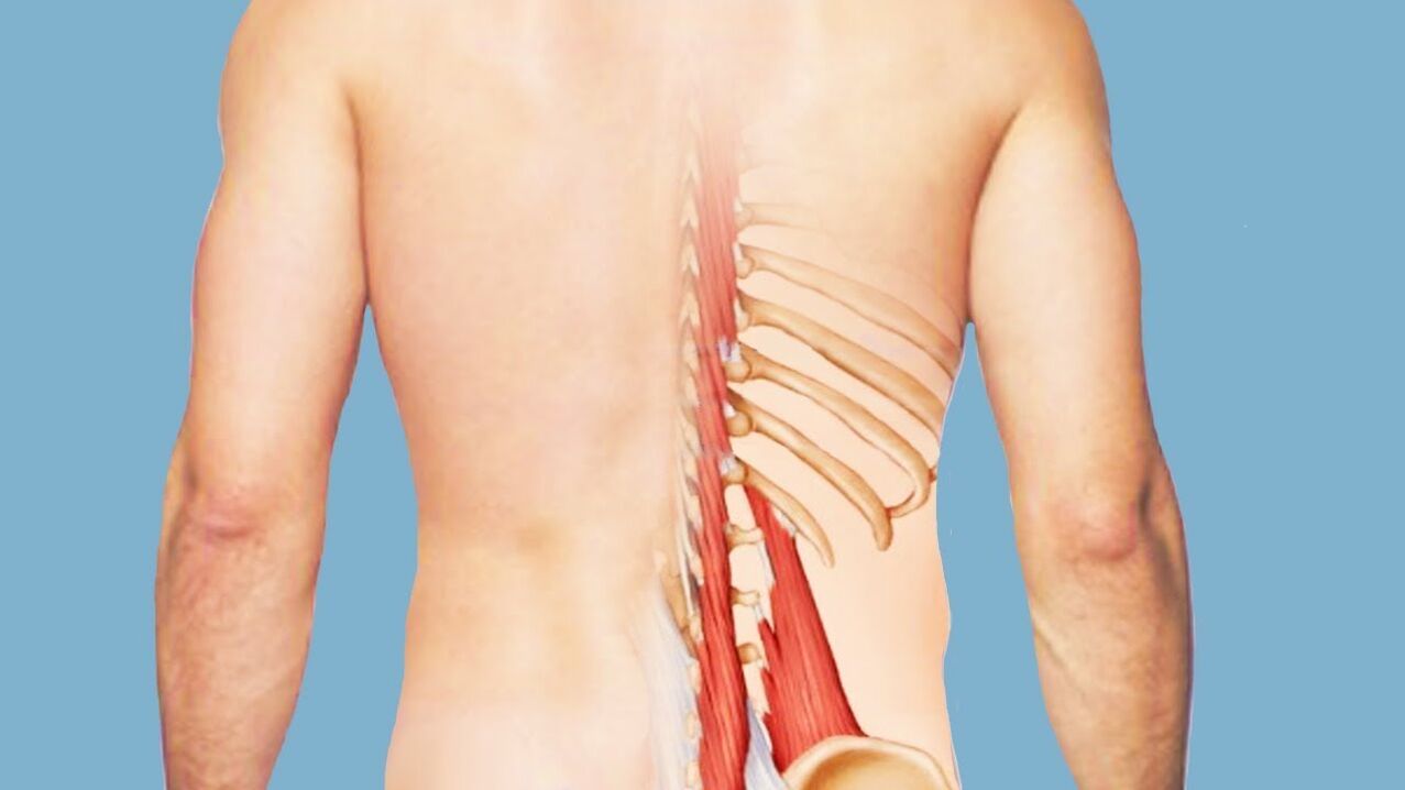 Myositis is a cause of back pain