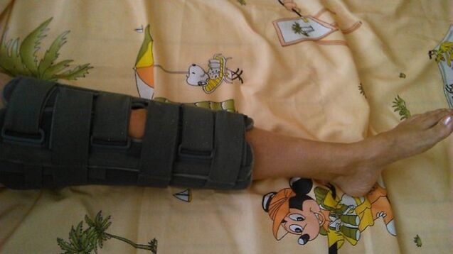 Immobilization for knee pain